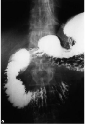 <p>What is this </p>