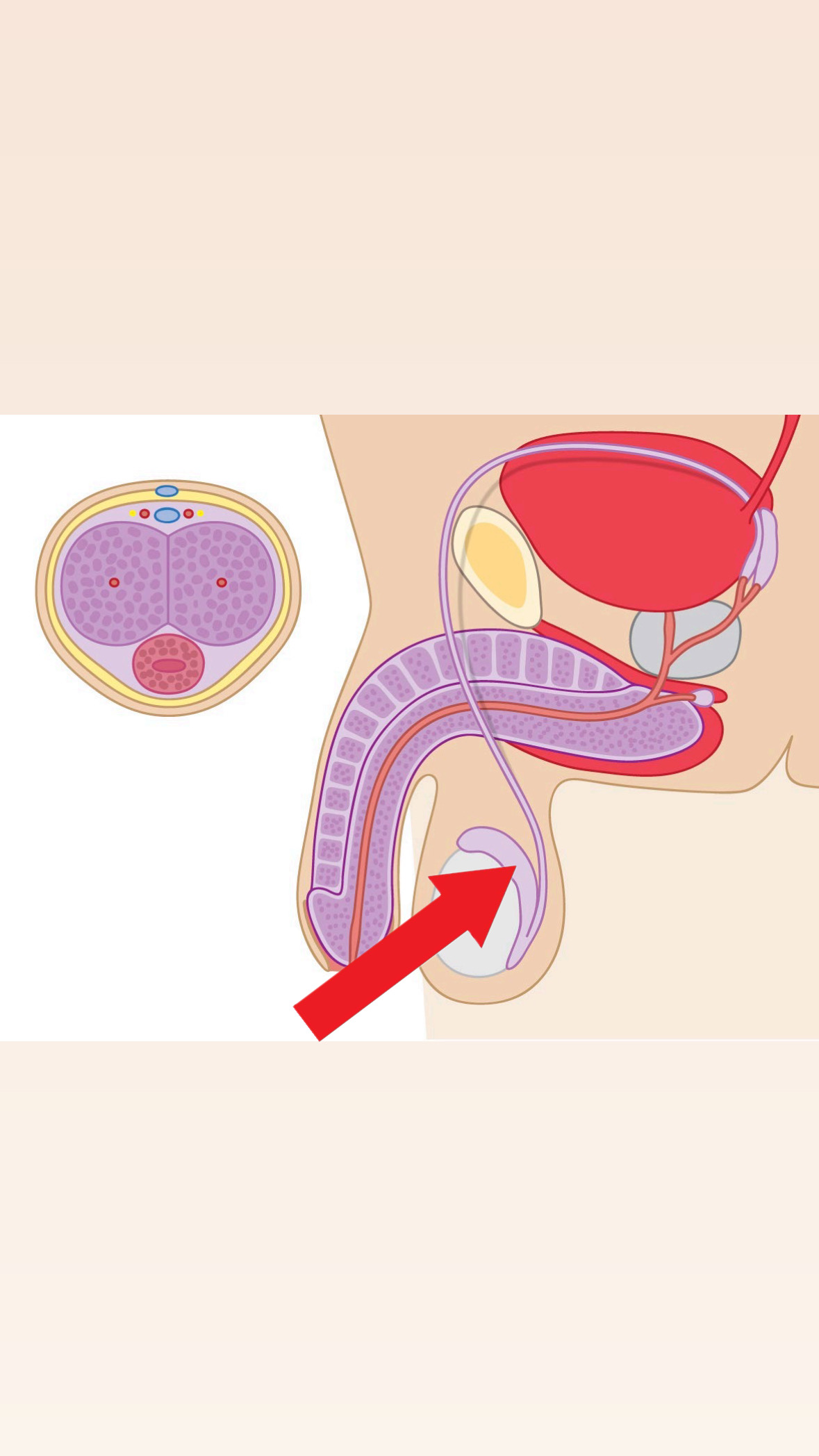 <p>Bitestikel (epididymis)</p>