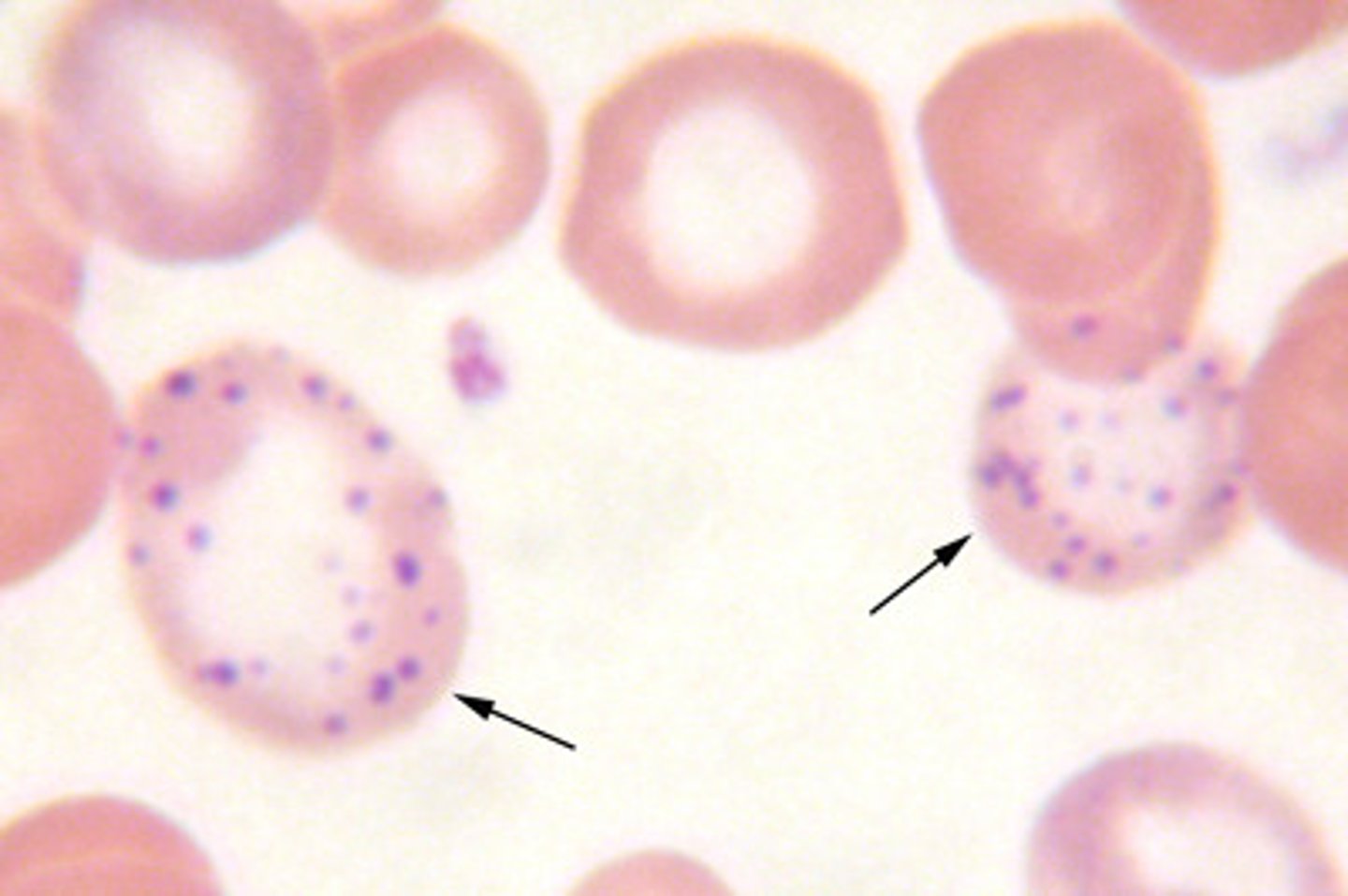 <p>(RBC inclusions)</p><p>the presence of small basophilic inclusions distributed throughout the RBC; represents abnormally staining ribosomes</p>