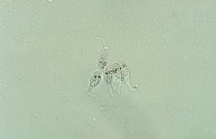 Caudate transitional epithelial cells