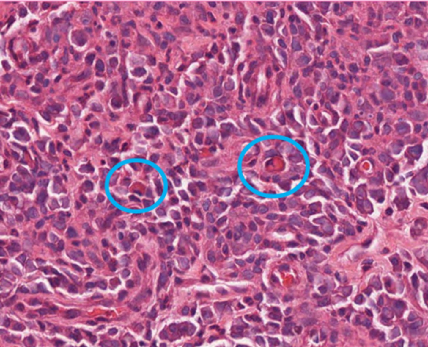 <p>These are plasma cells. what is circled?</p>