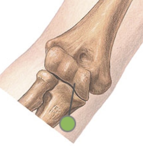 <p>Which bone landmark of the humerus is pulley-shaped and part of the elbow joint?</p>