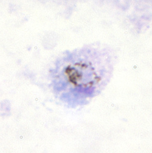 <p>Dr. Vicente Y. Belizario Jr.</p>