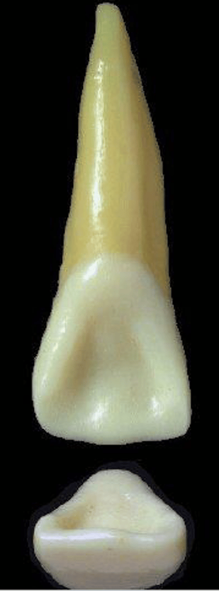 <p>what tooth is this &amp; why?</p>