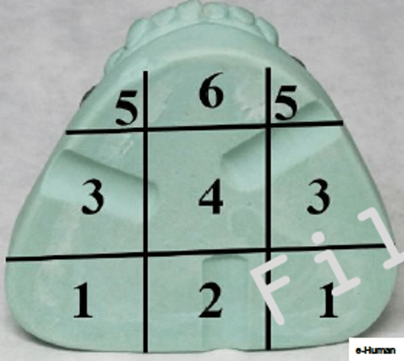 <p>ID the phase:</p>