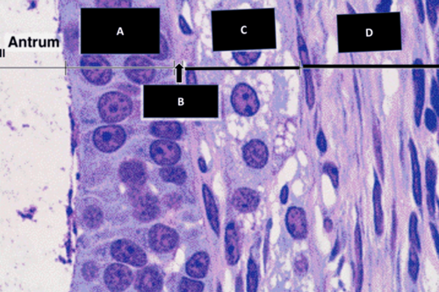 <p>outer wall of a mature follicle, b:</p>
