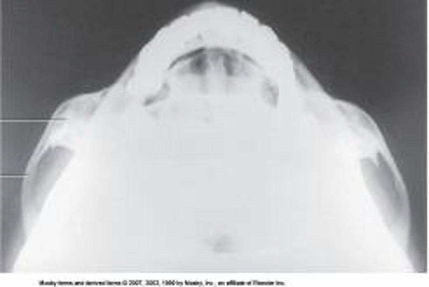 <p>What projection and anatomy is demonstrated in the image below?</p>