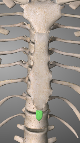 <p>miekkalisäke</p>