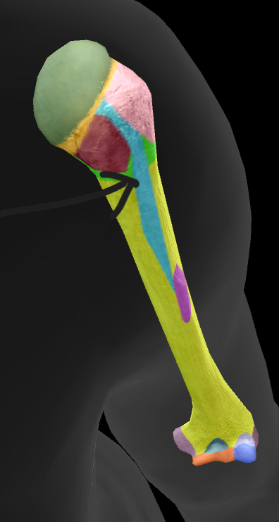 term image