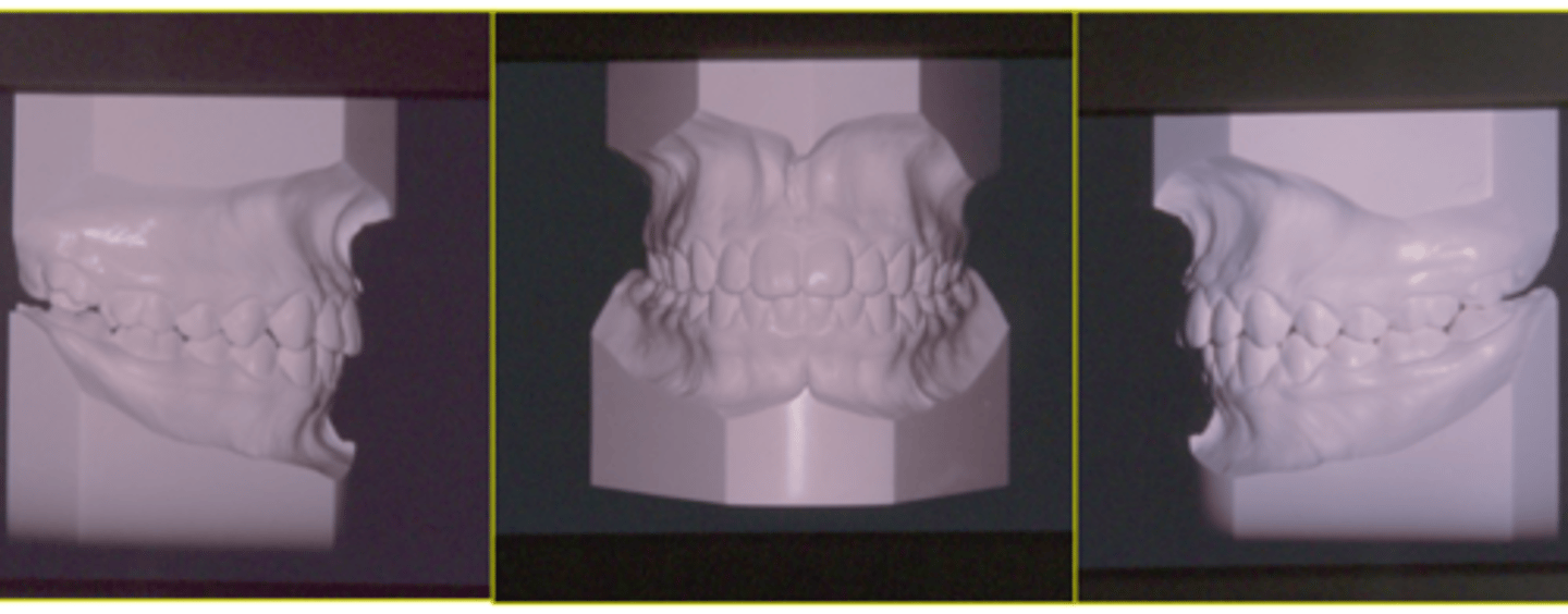 <p>ID the class of occlusion:</p>