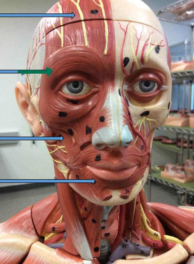 <p>Identify this muscle?</p>