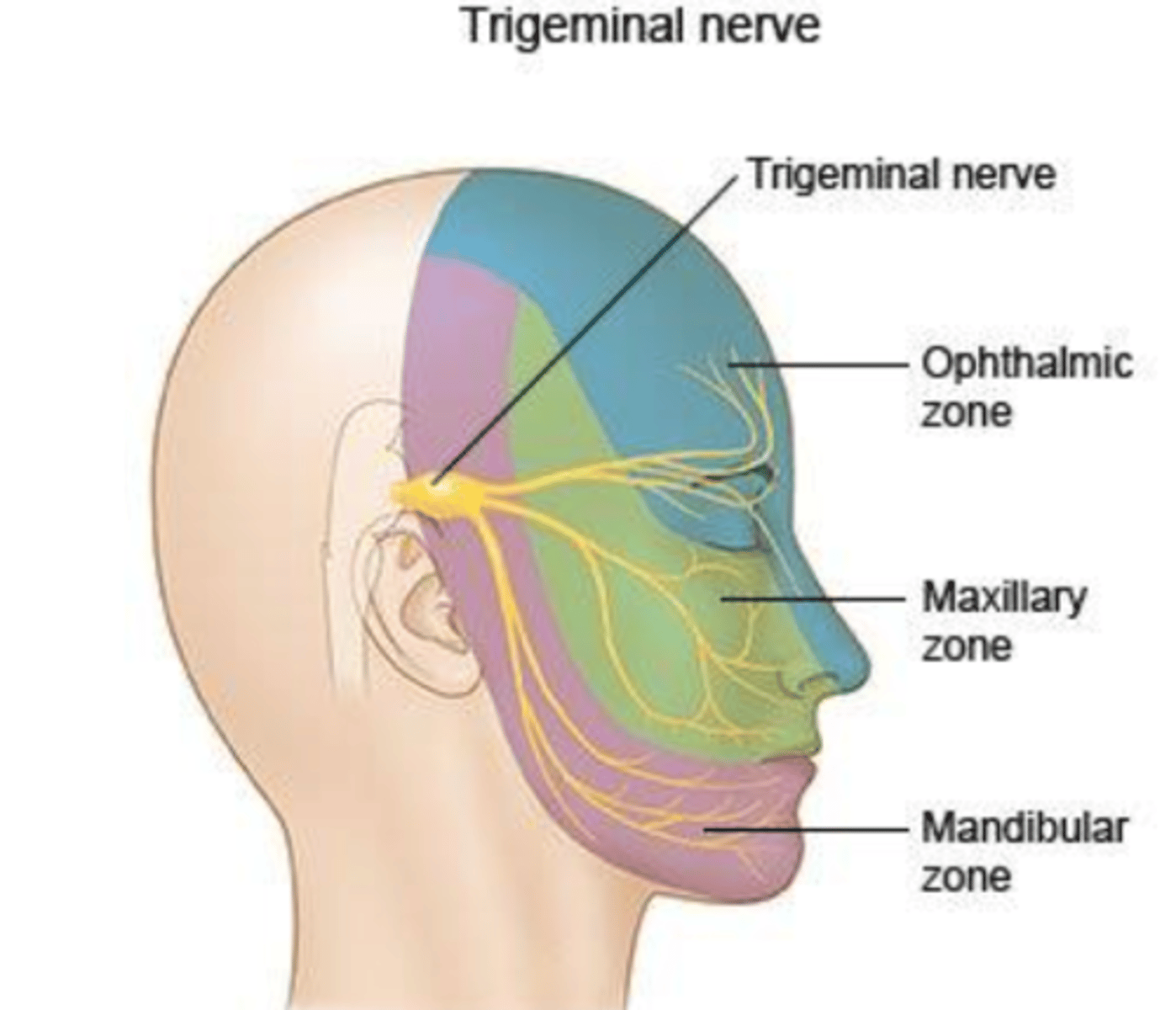 <p>- Inflammation of trigeminal nerve</p><p>- Expect to find loss of sensation in all 3 zones</p><p>- Touch patient with cotton swab from one side to the other</p><p>- May describe feeling of sunburn, numbness, etc.</p>