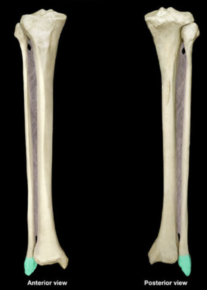 <p>Lateral malleolus</p>