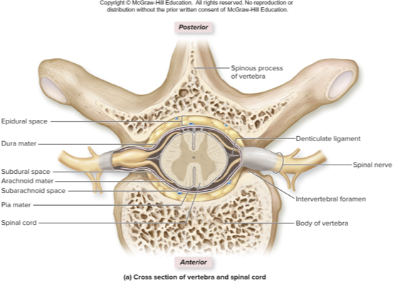 <p>what spinal cord meninge does this describe:</p><p>tough, outmost layer</p><p>one layer of dense irregular connective tissue that stabilizes spinal cord</p><p>subdural space: is between dura and arachnoid</p><p>epidural space: is between dura and vertebra; houses adipose, areolar connective tissue, blood vessels</p>