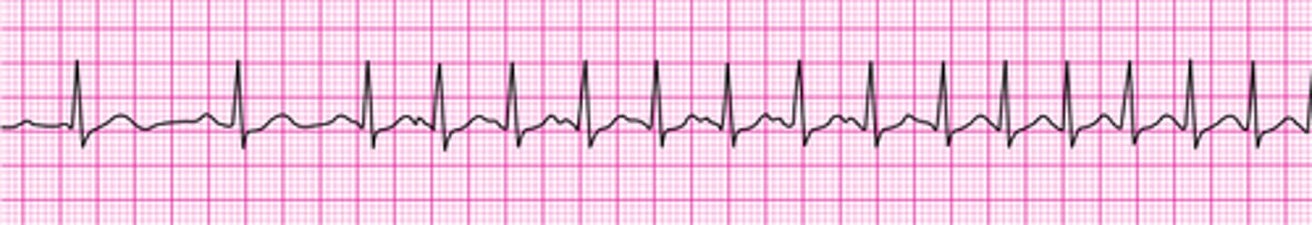 <p>What is this rhythm?</p>