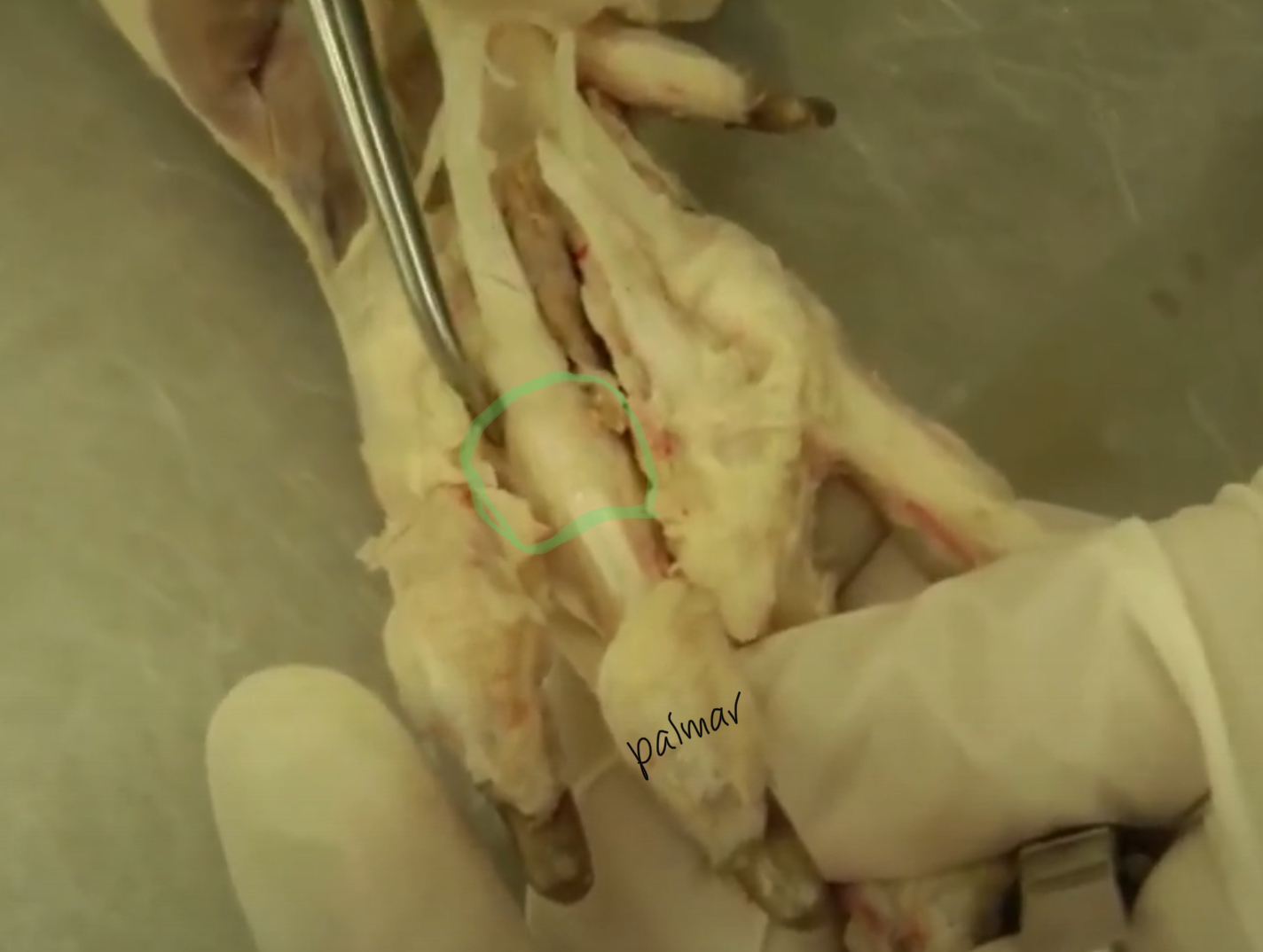 <p>(note of flexor manica)</p>