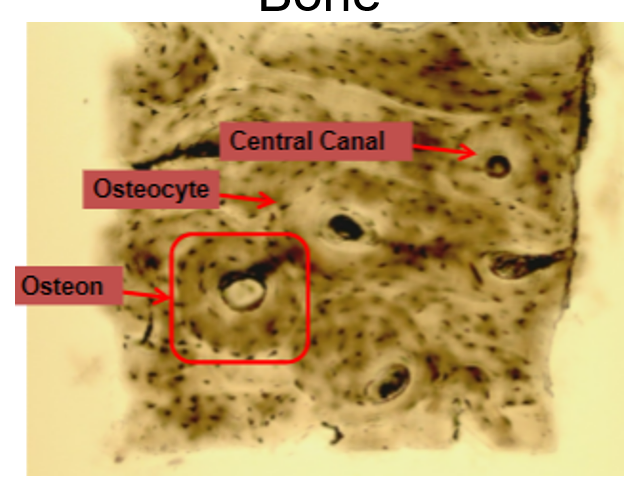 <p>consist of mineralized EM which is hydroxyapatite and living cells (osteocytes and collagen)</p><p>holes in matrix are called lucane this is where osteocyte production occuring</p><p>very vascular and heals readily</p>
