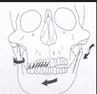 <ul><li><p>maintenance of occlusion </p></li></ul><p></p>