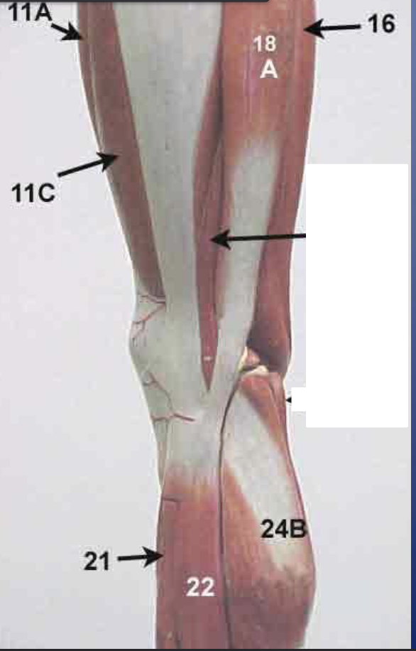 <p>What muscle is this? (<strong>22</strong>)*****</p>