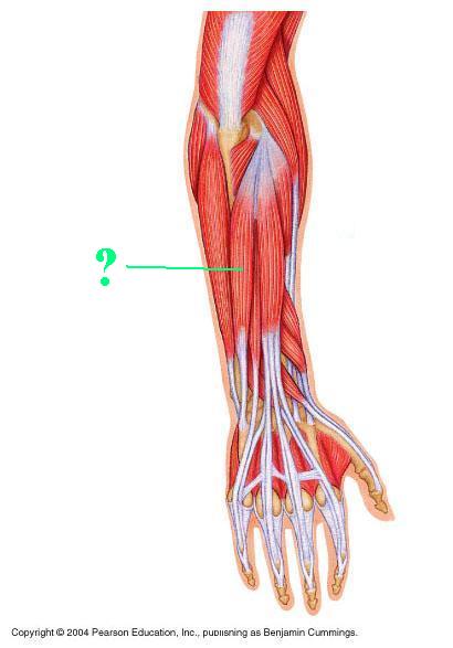 <p><span>Identify the indicated muscle</span></p>