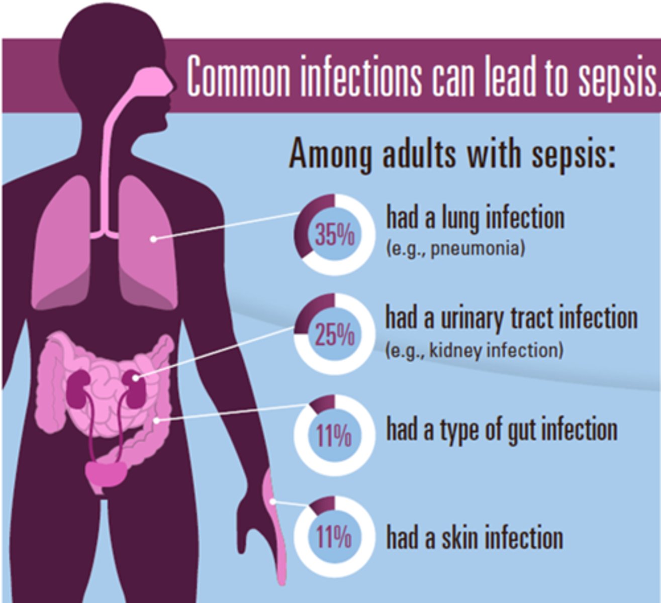 <p>- any pathogen can cause it</p><p>- respiratory infections = 50% of cases</p><p>- IV line contamination</p>