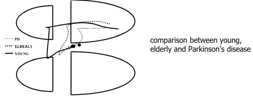 <ul><li><p>to initiate gait, we have to lift one leg off to be able to step forward.</p></li><li><p>Before taking one leg off, the person has to transfer the weight onto the other limb, otherwise you would fall over.</p></li><li><p>Pushing down on one limb means the CoP shifts to that limb to be able to take a step forward. </p></li></ul><p></p>