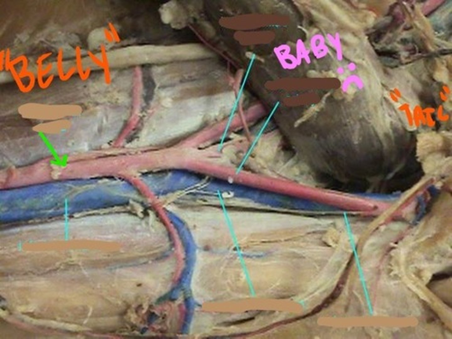 <p>identify the artery</p>