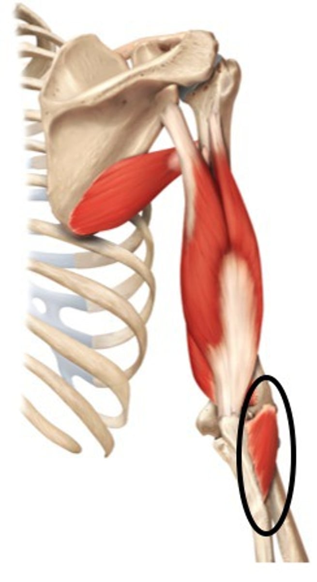 <p>lateral epicondyle of humerus</p>