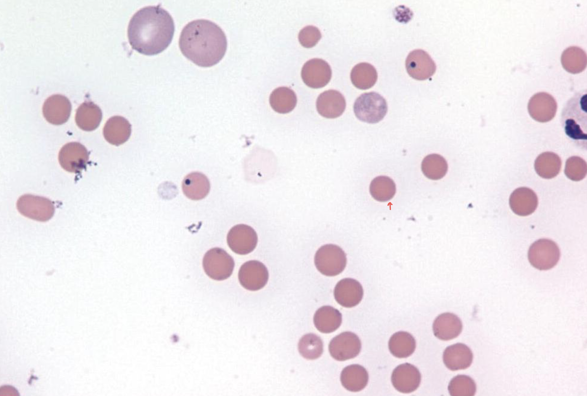 <p>what is the red arrow pointing to in this image?</p>