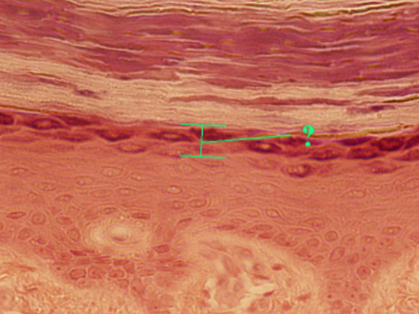 <p>stratum granulosum</p>