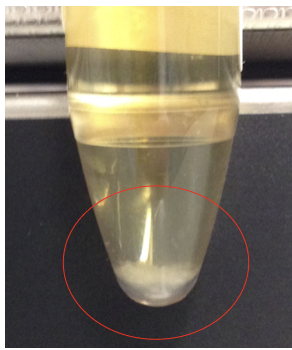 <p><span>How would you document this finding in a urine sample?</span></p><p></p>