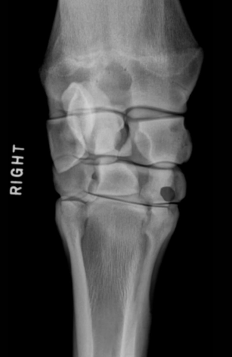 <p>What bone is highlighted?</p>