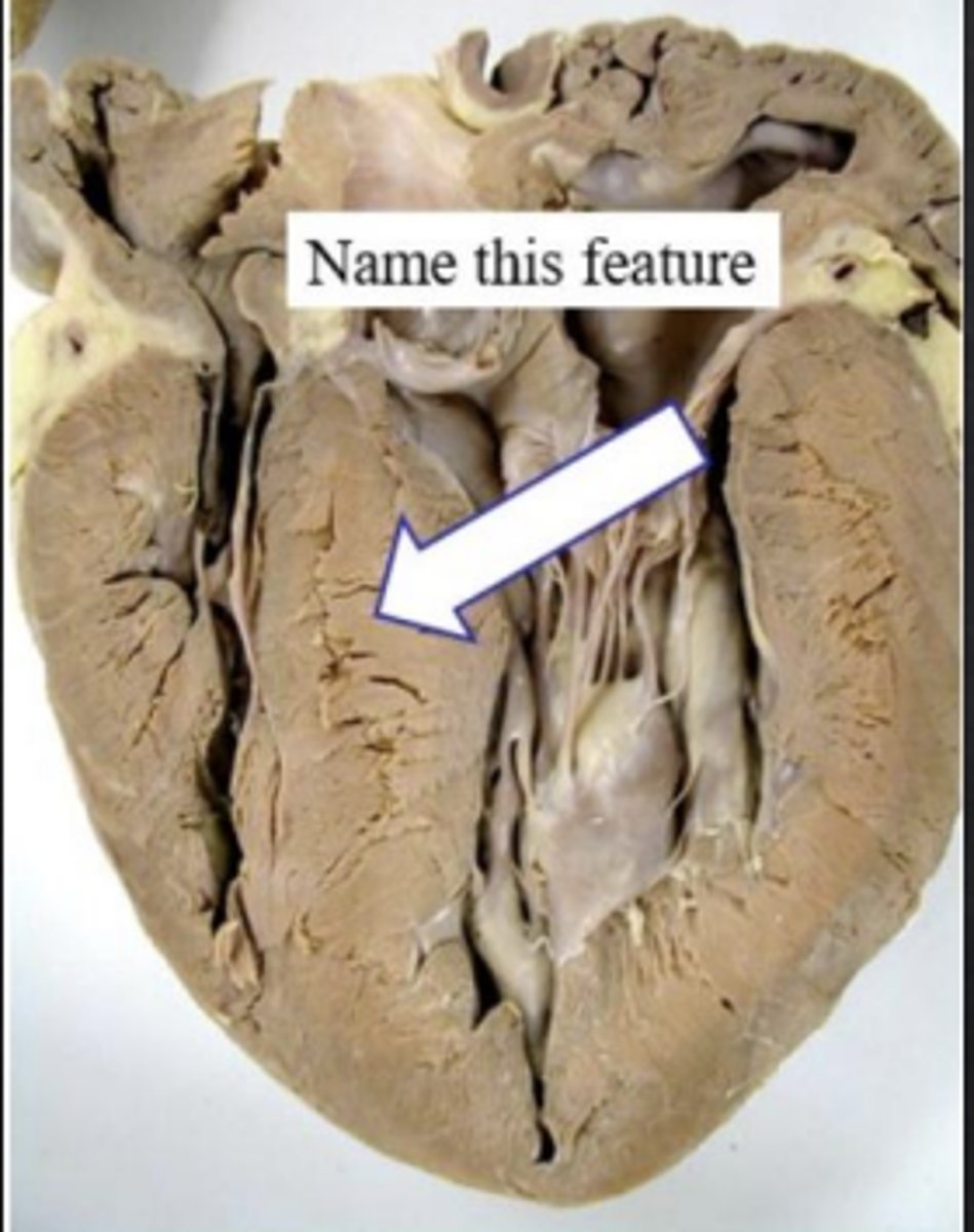 <p>What is this feature of the heart that is being pointed at?</p>