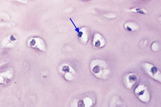 <p>Chondrocyte </p>