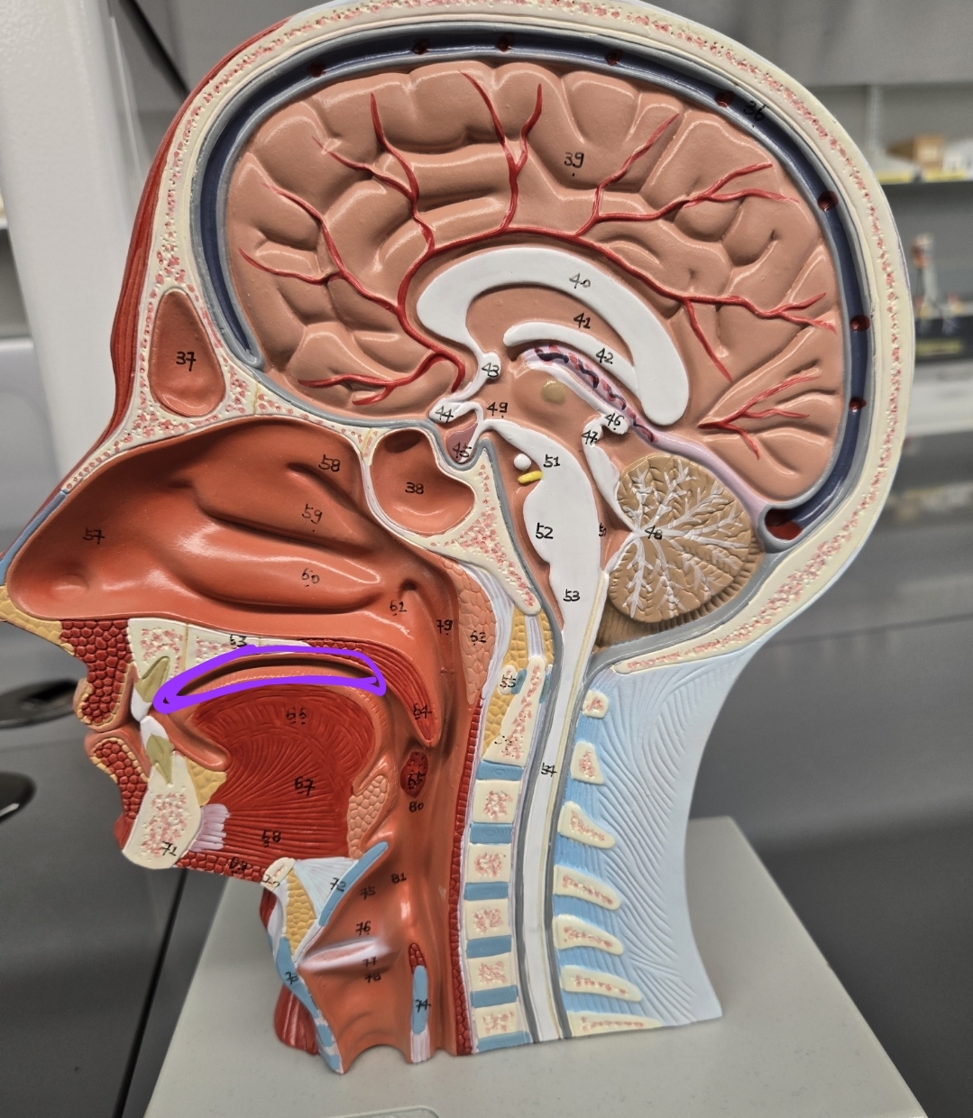 <p>Half head model: what structure is this?</p>