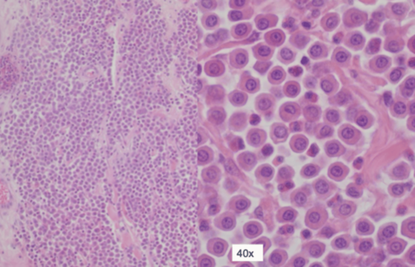 <p>Case 1 - Histopathology</p><p>why would you send this for histo?</p>