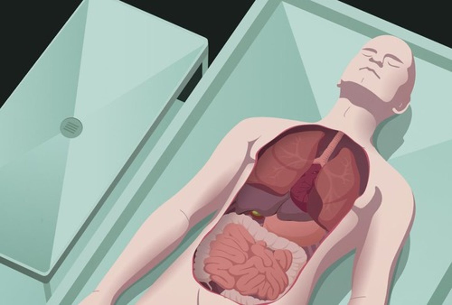 <p>examination of organs of a dead body to determine cause of death</p>