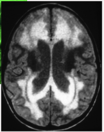 <p>what does this image show</p>