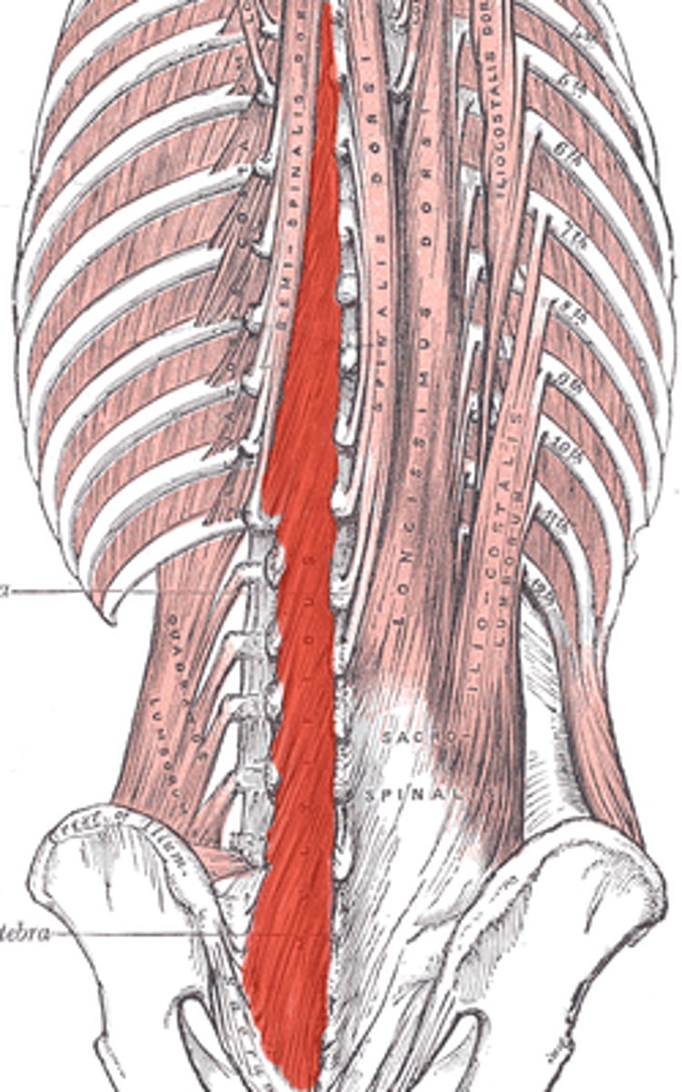 <p>o: sacrum, ilium, lumbar TP</p><p>i: SP at least 3 vertebrae away</p>