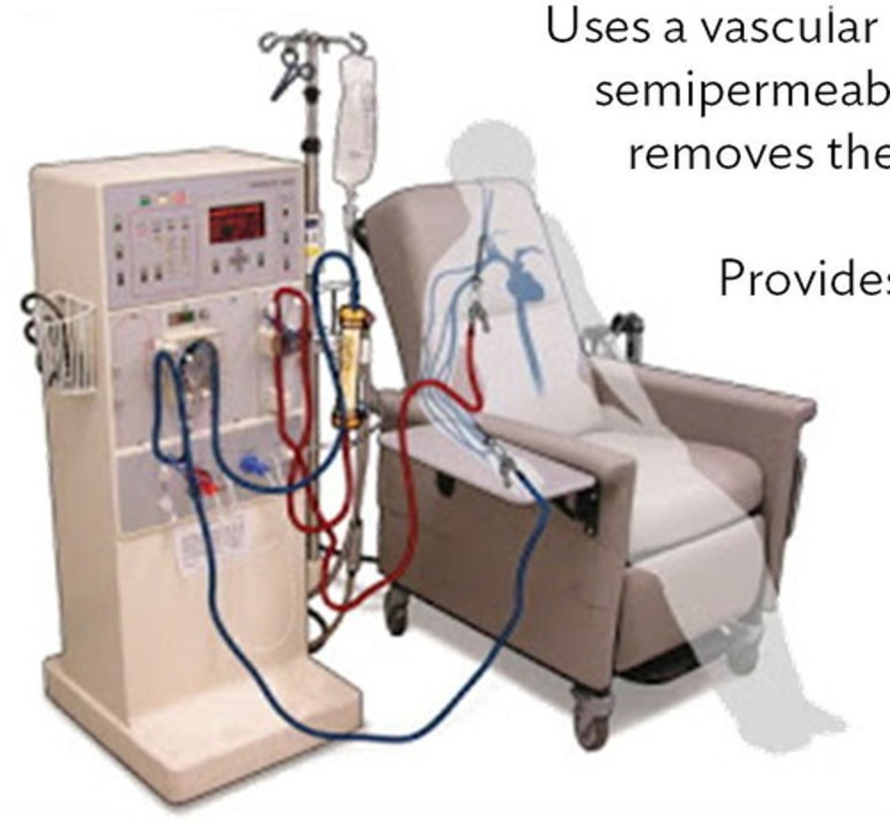 <p>Removal of fluids, Removal of toxins, Correct electrolyte balance</p>