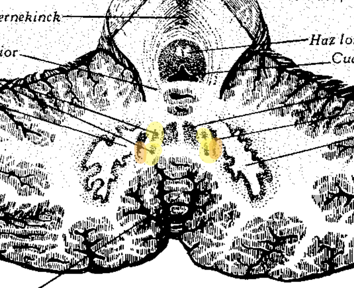 <p>Núcleo Interpósito</p><ul><li><p>Núcleos de paleocerebelo</p></li><li><p>Conexión con núcleo rojo mediante vía cerebelorrúbrica</p></li><li><p>Control del tono muscular</p></li></ul><p></p>