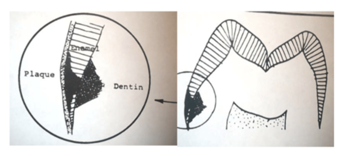<p>irregular cone</p>