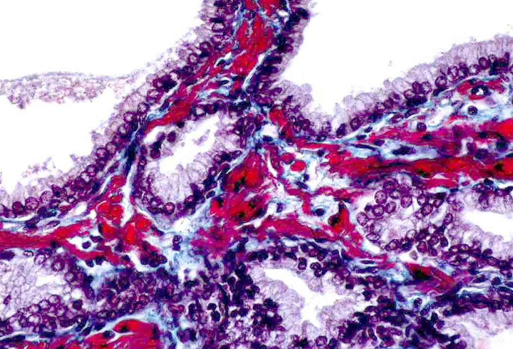 <p><span style="font-size: large">Observe the histological pattern of this specimen and select the correct identification from the list.</span></p><p><span style="font-size: large">GoldnerTrichrome Stain:</span></p><p><span style="font-size: large">nuclei - dark blue</span></p><p><span style="font-size: large">cytoplasm of epithelial cells - light blue-pink</span></p><p><span style="font-size: large">smooth muscle cells - red</span></p><p><span style="font-size: large">collagen- blue-green</span></p><p><span style="font-size: large">a) epididymis </span></p><p><span style="font-size: large">b) ovary</span></p><p><span style="font-size: large">c) prostate gland</span></p><p><span style="font-size: large">d) testis</span></p><p><span style="font-size: large">e) uterus</span></p>