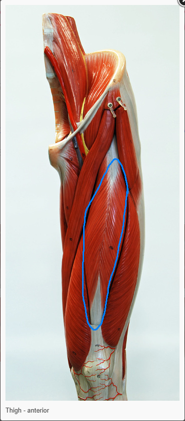<p>what is the name of the muscle circled </p>