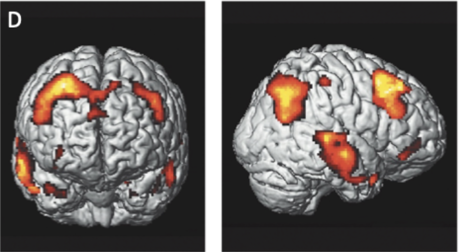 <p>detect small changes in brain metabolism (ex. oxygen use)</p>