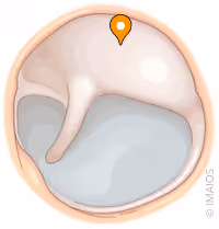 <p>what part of the ear is this</p>