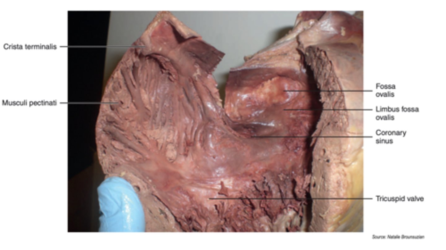 <p>vertical, muscular ridge on the posterior wall of the right atrium</p>