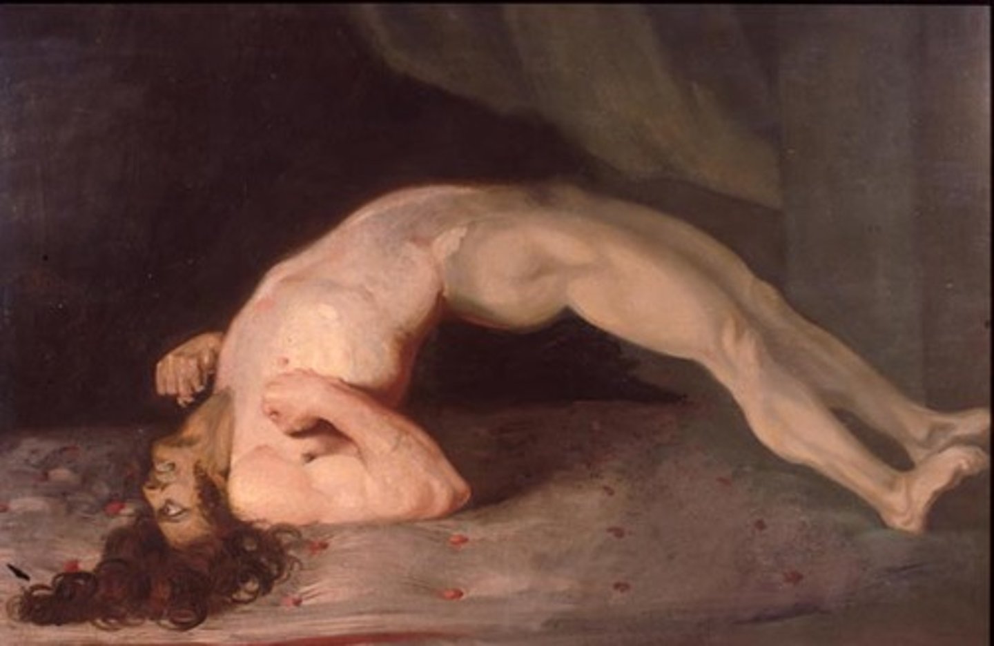 <p>causes tetanus</p>