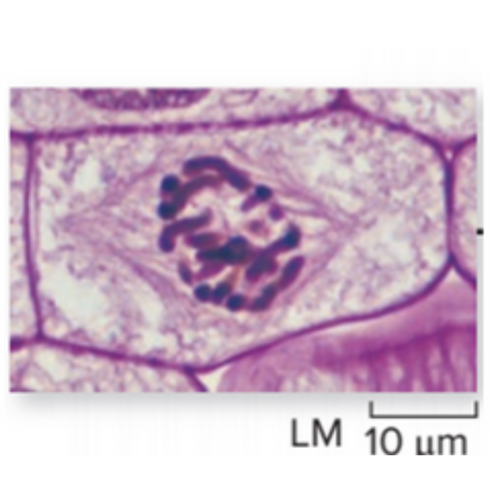 <p>What kind of cell is shown? Name the phase that it is experiencing.</p>