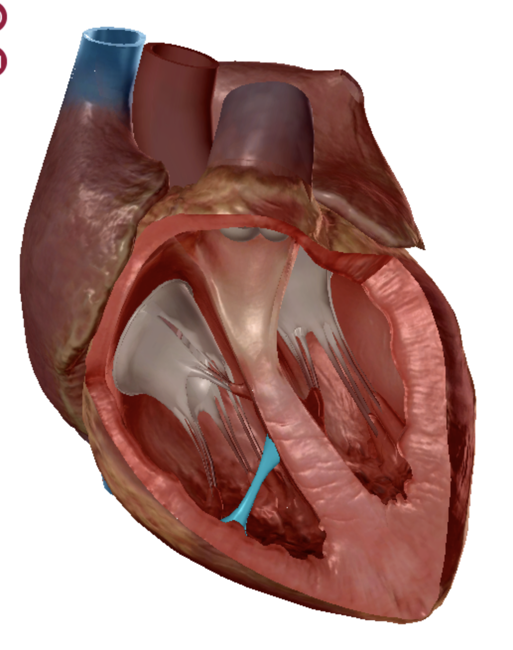 <p>moderator band </p>